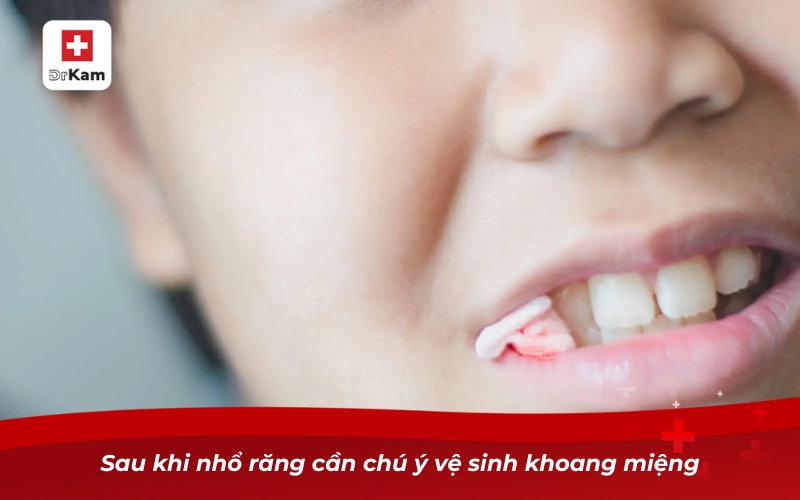 Sau khi nhổ răng cần chú ý vệ sinh khoang miệng