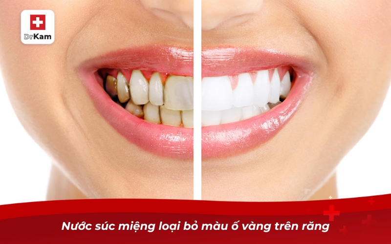 Nước súc miệng trắng răng có hiệu quả không?