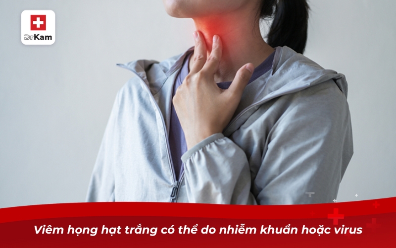 Viêm họng hạt trắng có thể do nhiễm khuẩn hoặc virus