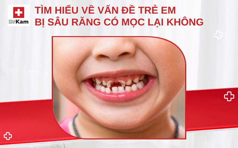 Tìm hiểu về vấn đề trẻ em bị sâu răng có mọc lại không?