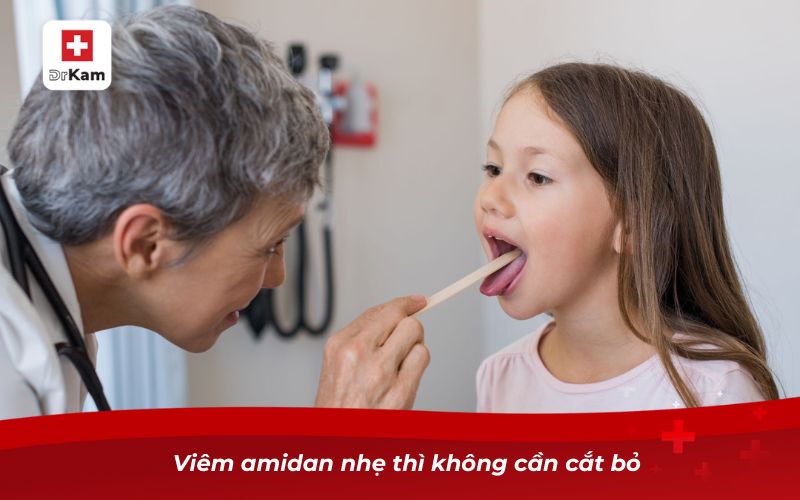 Viêm amidan mãn tính có nên cắt không? 3 Viêm amidan nhẹ thì không cần cắt bỏ