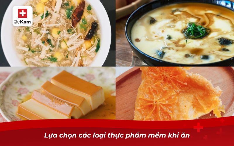 Viêm amidan mãn tính có nên cắt không? 4 Lựa chọn các loại thực phẩm mềm khi ăn