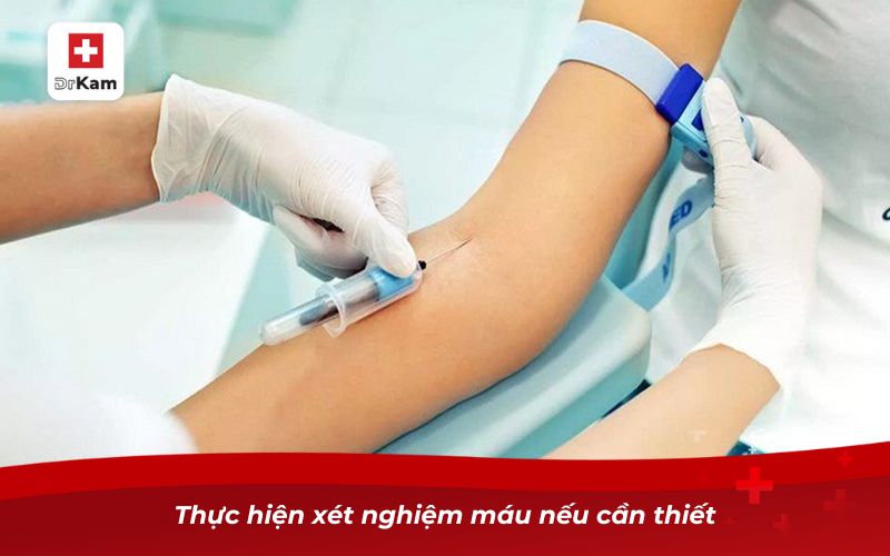 Viêm họng có tự khỏi không? Bí quyết xử lý bệnh hiệu quả 4 Thực hiện xét nghiệm máu nếu cần thiết