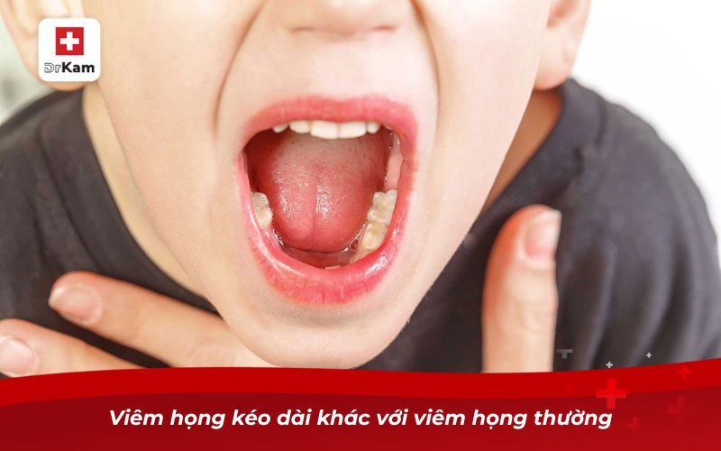 Viêm họng kéo dài khác với viêm họng thường