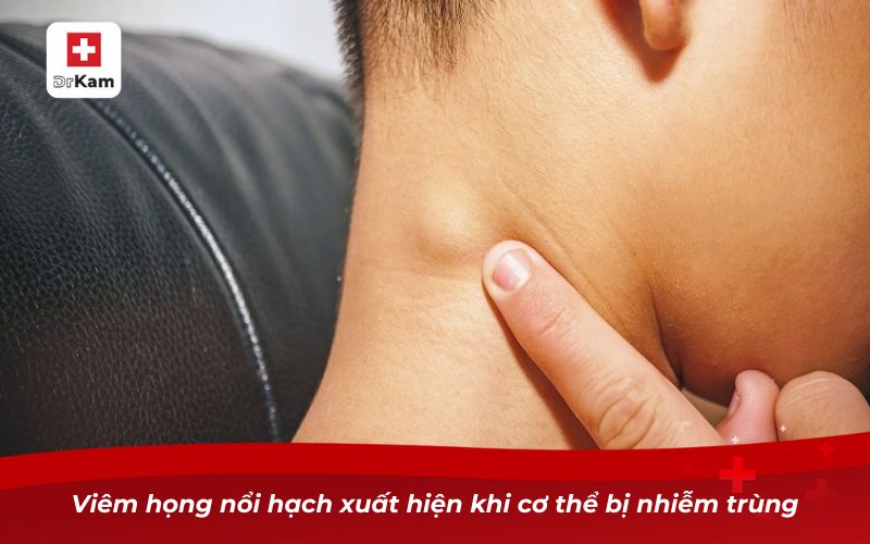 Viêm họng nổi hạch xuất hiện khi cơ thể bị nhiễm trùng