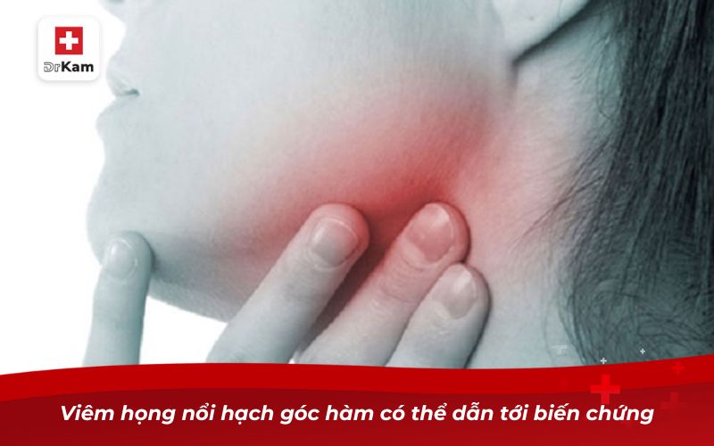 Viêm họng nổi hạch góc hàm có thể dẫn tới biến chứng