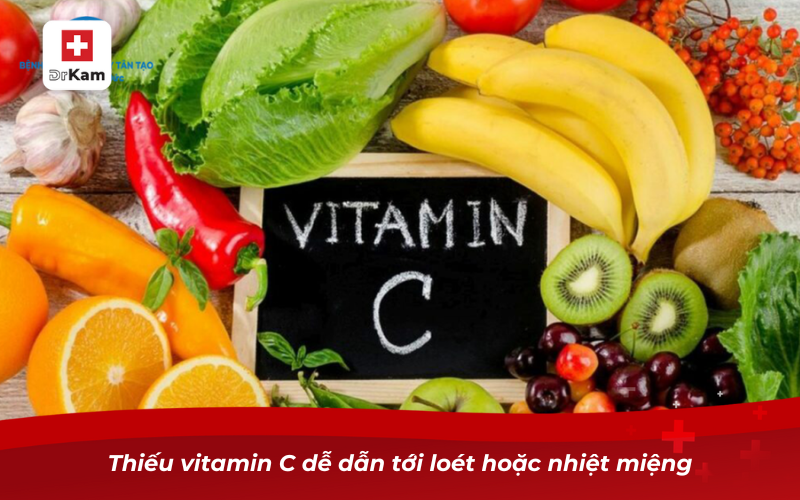 Thiếu vitamin C dễ dẫn tới loét hoặc nhiệt miệng