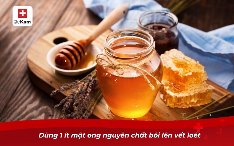 Dùng 1 ít mật ong nguyên chất bôi lên vết loét