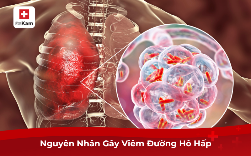 Nguyên Nhân Gây Viêm Đường Hô Hấp