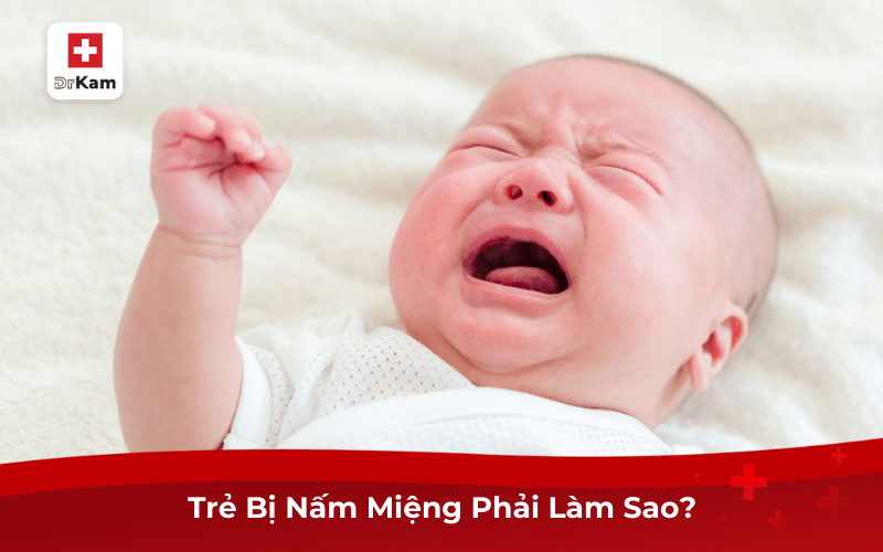 Trẻ Bị Nấm Miệng Phải Làm Sao?