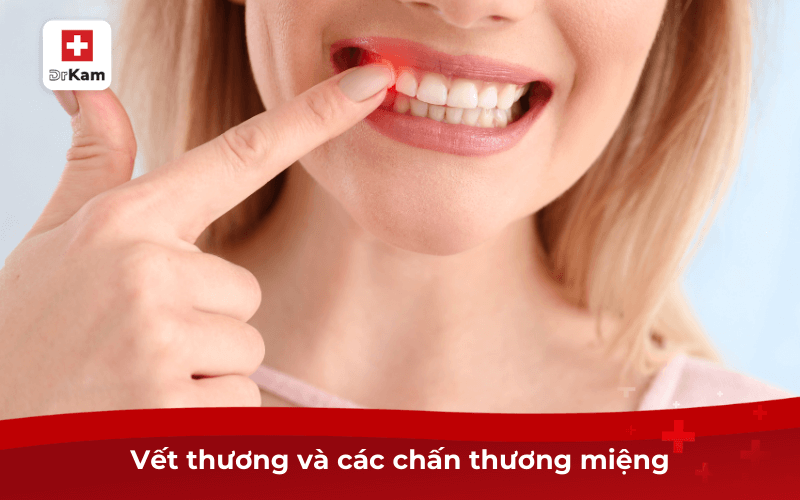 Vết thương và các chấn thương miệng