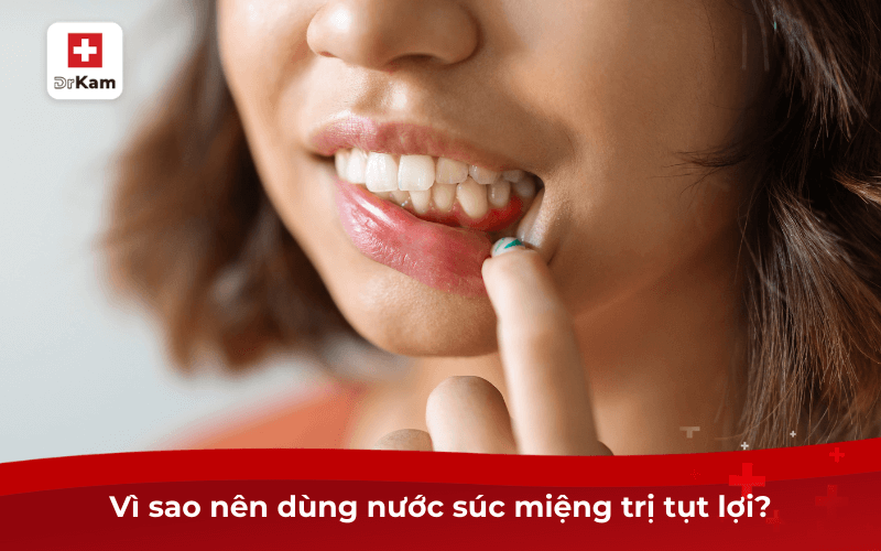 Top 5 loại nước súc miệng trị tụt lợi giá tốt hiệu quả 2 Vì sao nên dùng nước súc miệng trị tụt lợi?