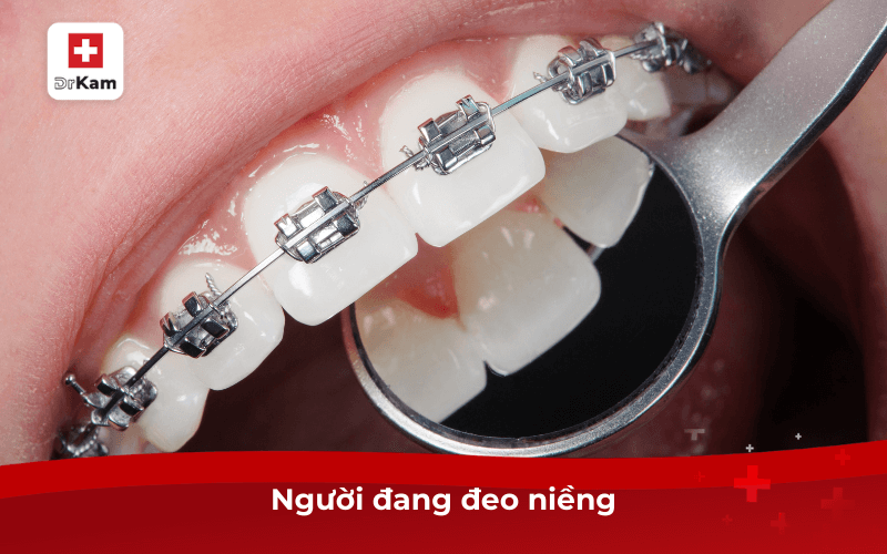 Người đang đeo niềng