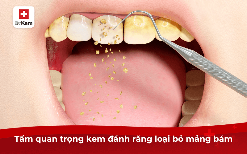 Tầm quan trọng kem đánh răng loại bỏ mảng bám