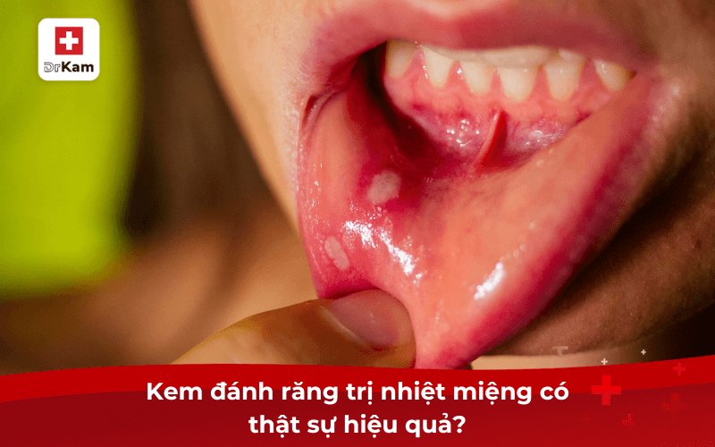 Top 5 kem đánh răng trị nhiệt miệng tốt nhất hiện nay được bác sĩ khuyên dùng 3 Kem đánh răng trị nhiệt miệng có thật sự hiệu quả?