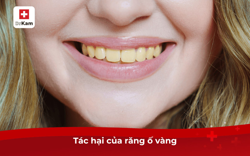 Tác hại của răng ố vàng