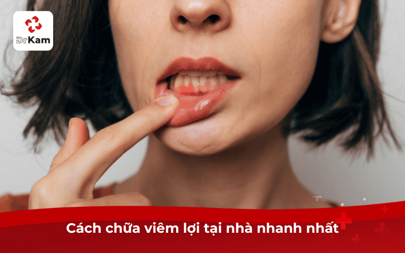 TOP 2 cách chữa viêm lợi tại nhà nhanh nhất, an toàn ngay lần đầu dùng 3 Cách chữa viêm lợi tại nhà nhanh nhất
