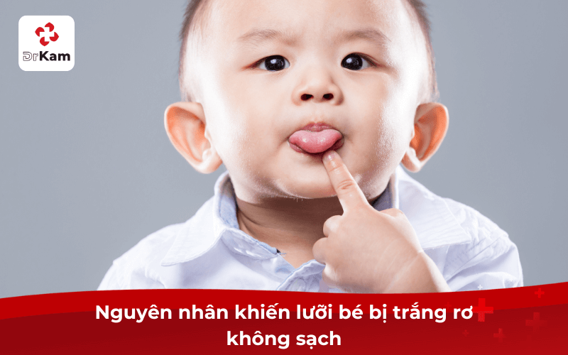 Nguyên nhân khiến lưỡi bé bị trắng rơ không sạch 