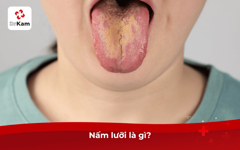 Nấm lưỡi là gì?