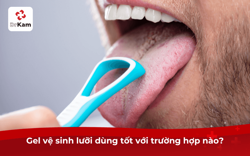 Gel vệ sinh lưỡi dùng tốt với trường hợp nào?
