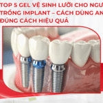 TOP 5 Gel vệ sinh lưỡi cho người trồng implant – Cách dùng an toàn đúng cách hiệu quả