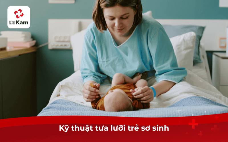 Kỹ thuật tưa lưỡi trẻ sơ sinh