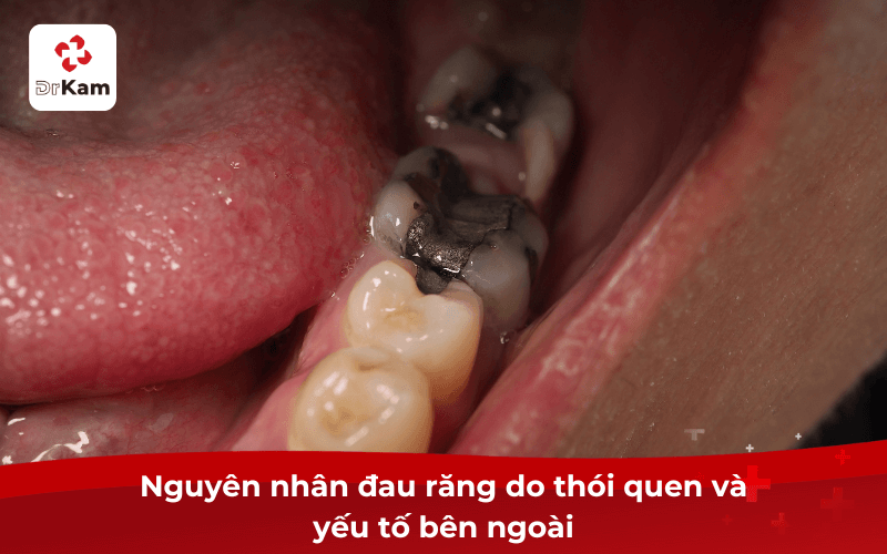 Nguyên nhân đau răng do thói quen và yếu tố bên ngoài