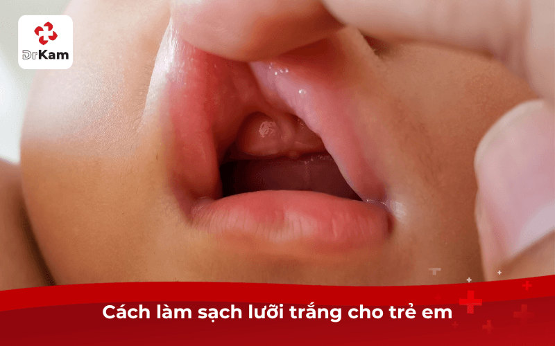 Cách làm sạch lưỡi trắng cho trẻ em