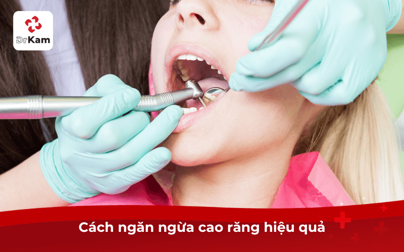 Cách ngừa cao răng hiệu quả