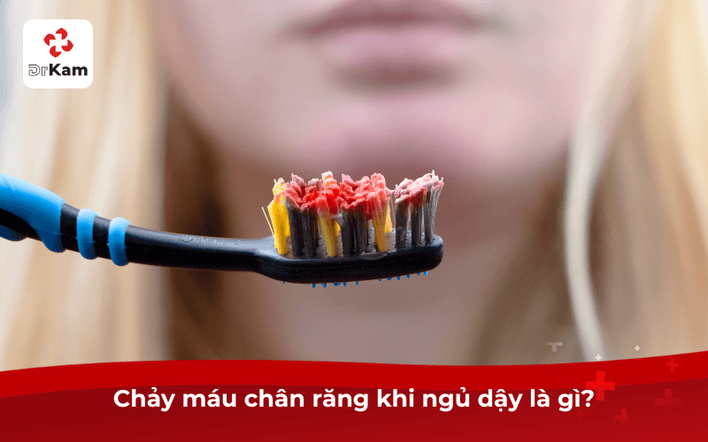 Chảy máu chân răng khi ngủ dậy - Nguyên nhân và cách khắc phục hiệu quả 3 Chảy máu chân răng khi ngủ dậy là gì?