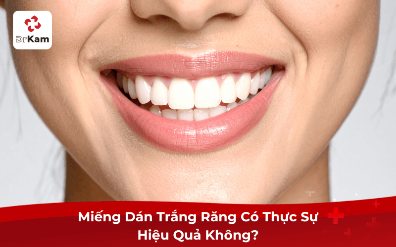 Miếng Dán Trắng Răng Có Thực Sự Hiệu Quả Không?