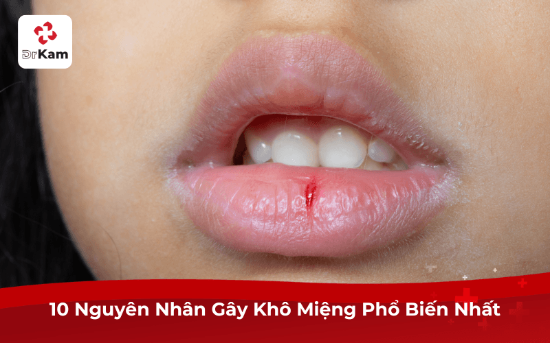10 Nguyên Nhân Gây Khô Miệng Phổ Biến Nhất