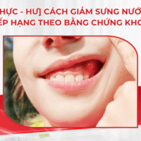 [Thực – hư] Cách giảm sưng nướu răng: Xếp hạng theo bằng chứng khoa học