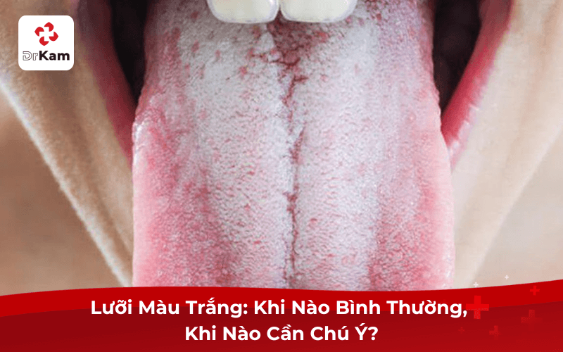 Lưỡi Màu Trắng: Khi Nào Bình Thường, Khi Nào Cần Chú Ý?