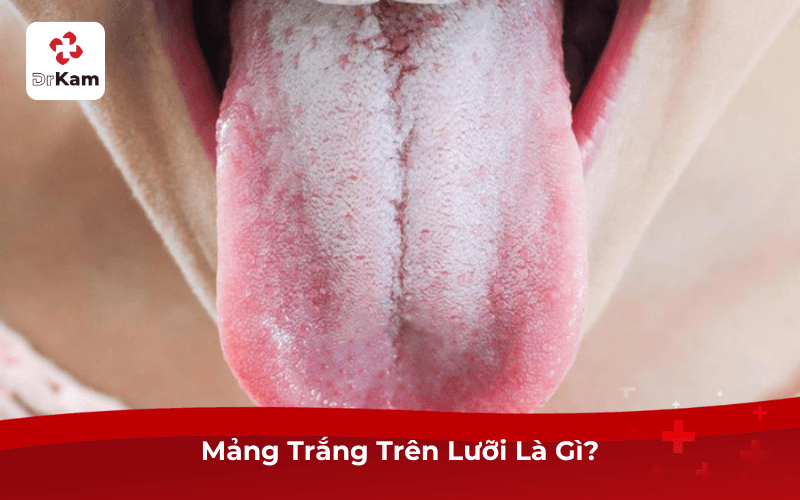 Mảng Trắng Trên Lưỡi Là Gì?