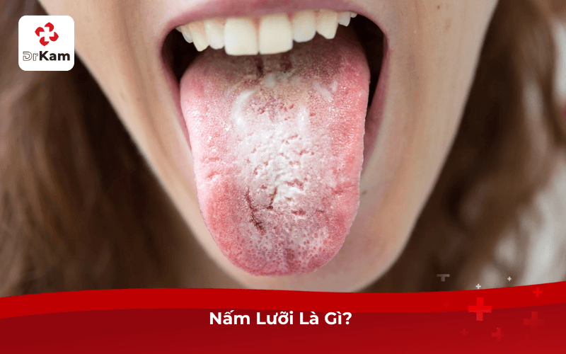 Nấm Lưỡi Là Gì?
