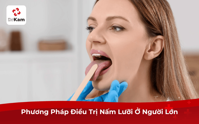 Phương Pháp Điều Trị Nấm Lưỡi Ở Người Lớn