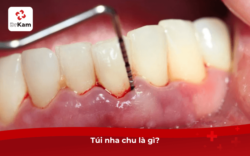 Túi nha chu là gì?