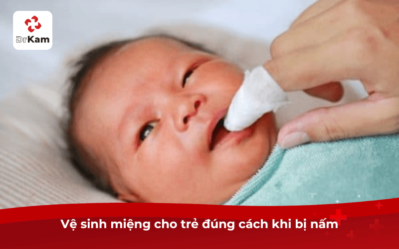 Vệ sinh miệng cho trẻ đúng cách khi bị nấm