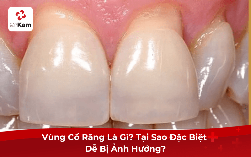 Vùng Cổ Răng Là Gì? Tại Sao Đặc Biệt Dễ Bị Ảnh Hưởng?
