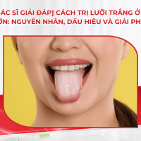 [Bác sĩ giải đáp] Cách trị lưỡi trắng ở người lớn: Nguyên nhân, dấu hiệu và giải pháp đúng