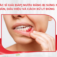 [Bác sĩ giải đáp] Nướu răng bị sưng: Nguyên nhân, dấu hiệu và cách xử lý đúng