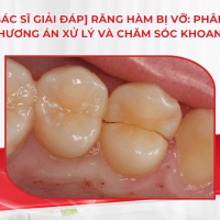 [Bác sĩ giải đáp] Răng hàm bị vỡ: Phân loại, phương án xử lý và chăm sóc khoang miệng