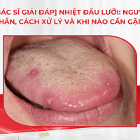 [Bác sĩ giải đáp] Nhiệt đầu lưỡi: Nguyên nhân, cách xử lý và khi nào cần gặp bác sĩ