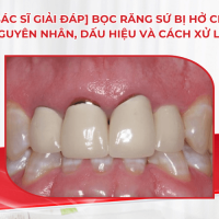 [Bác sĩ giải đáp] Bọc răng sứ bị hở chân: Nguyên nhân, dấu hiệu và cách xử lý đúng