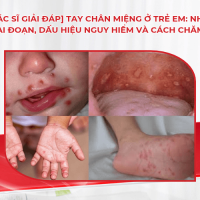[Bác sĩ giải đáp] Tay chân miệng ở trẻ em: Nhận biết 4 giai đoạn, dấu hiệu nguy hiểm và cách chăm sóc đúng