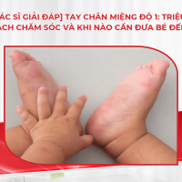 [Bác sĩ giải đáp] Tay chân miệng độ 1: Triệu chứng, cách chăm sóc và khi nào cần đưa bé đến viện