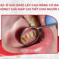 [Bác sĩ giải đáp] Lấy cao răng có đau không? Giải đáp chi tiết cho người lần đầu