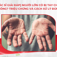[Bác sĩ giải đáp] Người lớn có bị tay chân miệng không? Triệu chứng và cách xử lý đúng