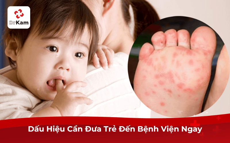 Dấu Hiệu Cần Đưa Trẻ Đến Bệnh Viện Ngay
